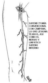 Resultado de imagen de gimolimpo